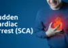 What You Need to Know About Sudden Cardiac Arrest (SCA) Sudden Cardiac Arrest (SCA): What You Need to Know
