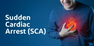 What You Need to Know About Sudden Cardiac Arrest (SCA) Sudden Cardiac Arrest (SCA): What You Need to Know