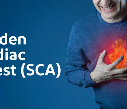 What You Need to Know About Sudden Cardiac Arrest (SCA) Sudden Cardiac Arrest (SCA): What You Need to Know