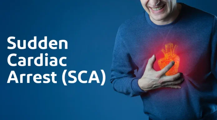 What You Need to Know About Sudden Cardiac Arrest (SCA) Sudden Cardiac Arrest (SCA): What You Need to Know
