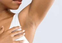 What Is Hidradenitis Suppurativa? Hidradenitis Suppurativa: Causes, Symptoms, and Treatment