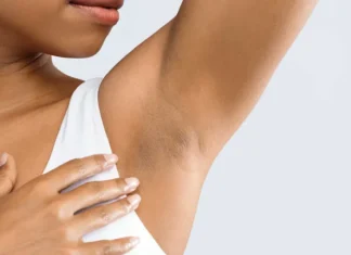 What Is Hidradenitis Suppurativa? Hidradenitis Suppurativa: Causes, Symptoms, and Treatment