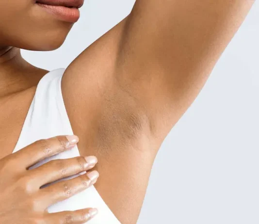 What Is Hidradenitis Suppurativa? Hidradenitis Suppurativa: Causes, Symptoms, and Treatment