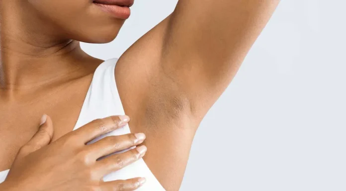What Is Hidradenitis Suppurativa? Hidradenitis Suppurativa: Causes, Symptoms, and Treatment