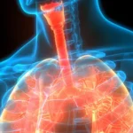 Despite Breakthroughs, Cystic Fibrosis Answers Remain Elusive Insights into Cystic Fibrosis: Causes, Symptoms, & Treatment