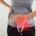 Polycystic Ovary Syndrome: Causes, Diagnosis, and Treatment Polycystic ovary syndrome (PCOS): Causes and Treatment