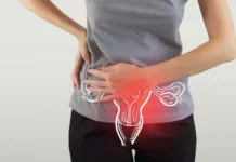 Polycystic Ovary Syndrome: Causes, Diagnosis, and Treatment Polycystic ovary syndrome (PCOS): Causes and Treatment