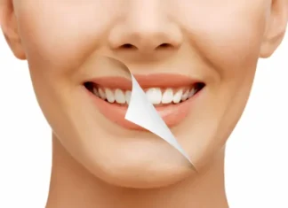 Are Porcelain Veneers the Best Choice for a Smile Makeover? Porcelain Veneers: Top Smile Makeover?