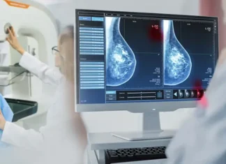 Inflammatory Breast Cancer (IBC): Diagnosis and Treatment Inflammatory Breast Cancer (IBC): Diagnosis and Treatment