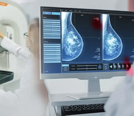 Inflammatory Breast Cancer (IBC): Diagnosis and Treatment Inflammatory Breast Cancer (IBC): Diagnosis and Treatment