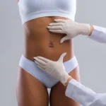 Liposuction: What you need to know Liposuction: What to Know—Expert Insights and Guidance
