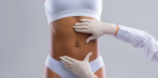 Liposuction: What to Know—Expert Insights and Guidance