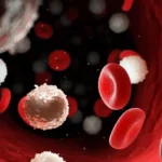 Leukaemia: Causes, Symptoms, Diagnosis, and Treatment Leukaemia: Causes, Symptoms, Diagnosis, and Treatment