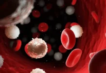 Leukaemia: Causes, Symptoms, Diagnosis, and Treatment Leukaemia: Causes, Symptoms, Diagnosis, and Treatment