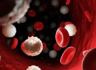 Leukaemia: Causes, Symptoms, Diagnosis, and Treatment Leukaemia: Causes, Symptoms, Diagnosis, and Treatment