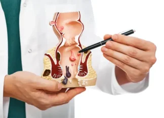 Hemorrhoids: Swollen veins in the rectum and anus Hemorrhoids: Swollen Veins in the Rectum and Anus—Symptoms