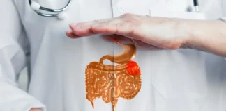 Peptic Ulcers: Symptoms, Causes, Treatment, and Prevention Peptic Ulcers: Know the Signs, Prevention, and Treatment