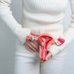 Ovarian Cysts: Symptoms, Causes, and Treatment Ovarian Cysts: Don't Panic, Get Informed-Causes & Treatment