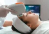 Fractional Laser Treatment For Younger Skin Rejuvenate Your Skin With Fractional Laser Treatments